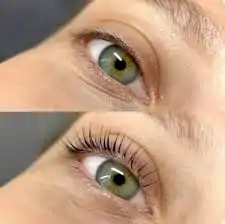 cils1